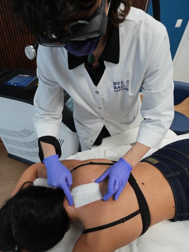 Les soins post-séance font partie des points clés pour un détatouage réussi !
Bien réalisés, ils vous aideront à obtenir le meilleur résultat final possible.

🩹 Le pansement permet d’éviter les frottements sur les zones sensibles pour faciliter la cicatrisation mais aussi de protéger du soleil en cette période estivale ☀️

Découvrez prochainement une vidéo sur toutes nos recommandations des soins à effectuer après votre rendez-vous 📹

#detatouage #byebadtattoo #tattooremoval #detatouagesuisse
#foreverisover #lasertattooremoval #picoway #badtattoos